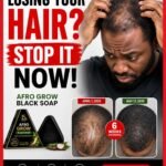 Losing your hair